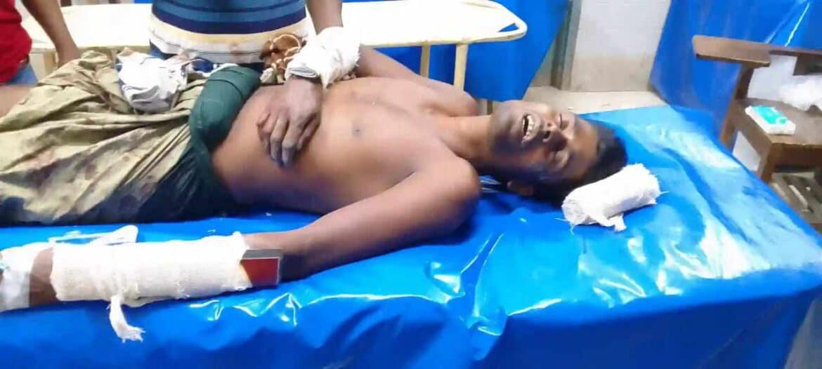 গাংনীতে গাঁজা ছিনিয়ে নেওয়ার অভিযোগে এক ব্যক্তির হাত-পা ভেঙ্গে দিল মাদক ব্যবসায়ীরা